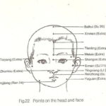 cabeza niño puntos acupuntura